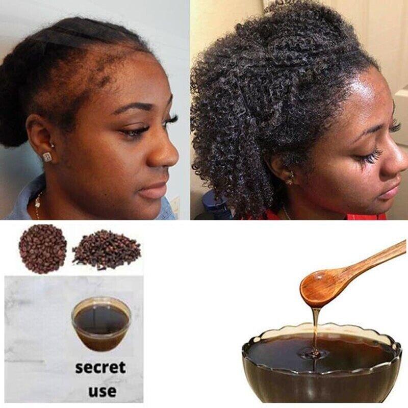 hair growth treatments