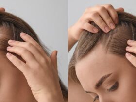 How to improve hair growth for men over 40