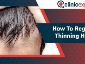 How to regrow thinning hair in men over 40