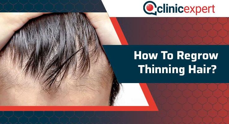 How to regrow thinning hair in men over 40