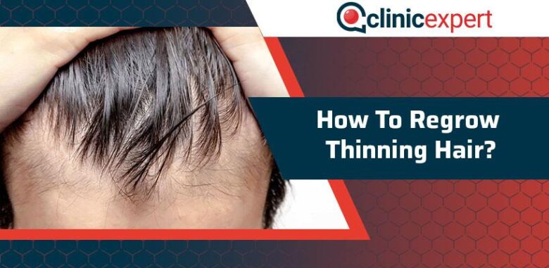 How to regrow thinning hair in men over 40