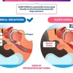 Testosterone therapy and sleep apnea