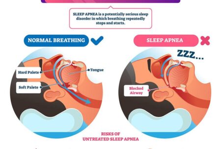 Testosterone therapy and sleep apnea