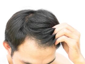 How to regrow hair for men over 40