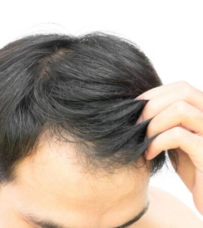 How to regrow hair for men over 40
