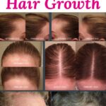 Hair growth scalp massage for men over 40