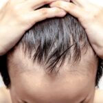 How to reverse hair loss in men over 40