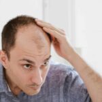 Hair growth for balding men over 40