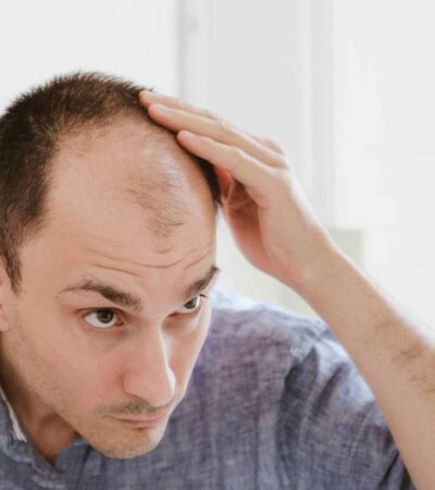 Hair growth for balding men over 40