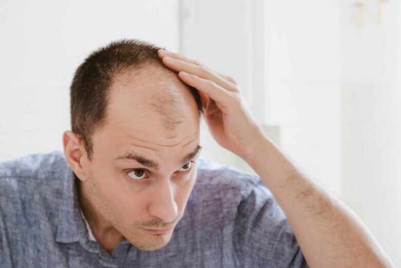 Hair growth for balding men over 40