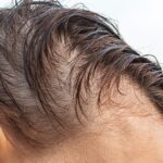 Best hair care for thinning hair in men over 40