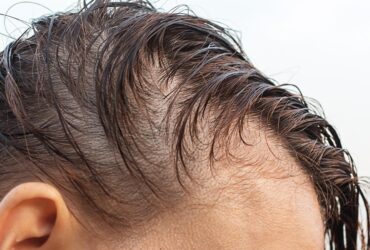 Best hair care for thinning hair in men over 40