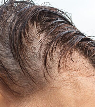 Best hair care for thinning hair in men over 40