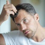 How to reduce hair shedding in men over 40