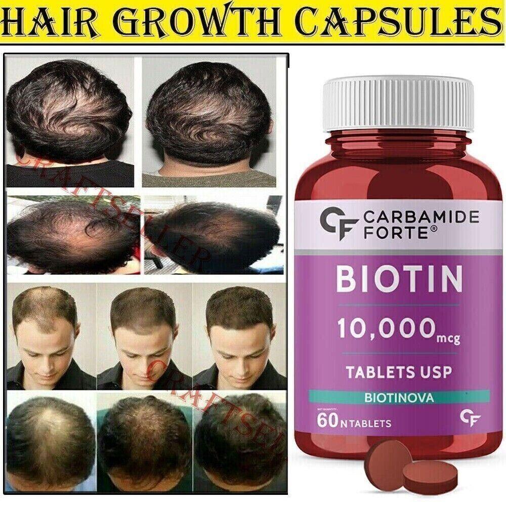 hair growth vitamins