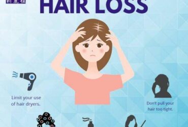 Hair loss prevention for men over 40