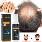 How to stimulate hair regrowth for men over 40