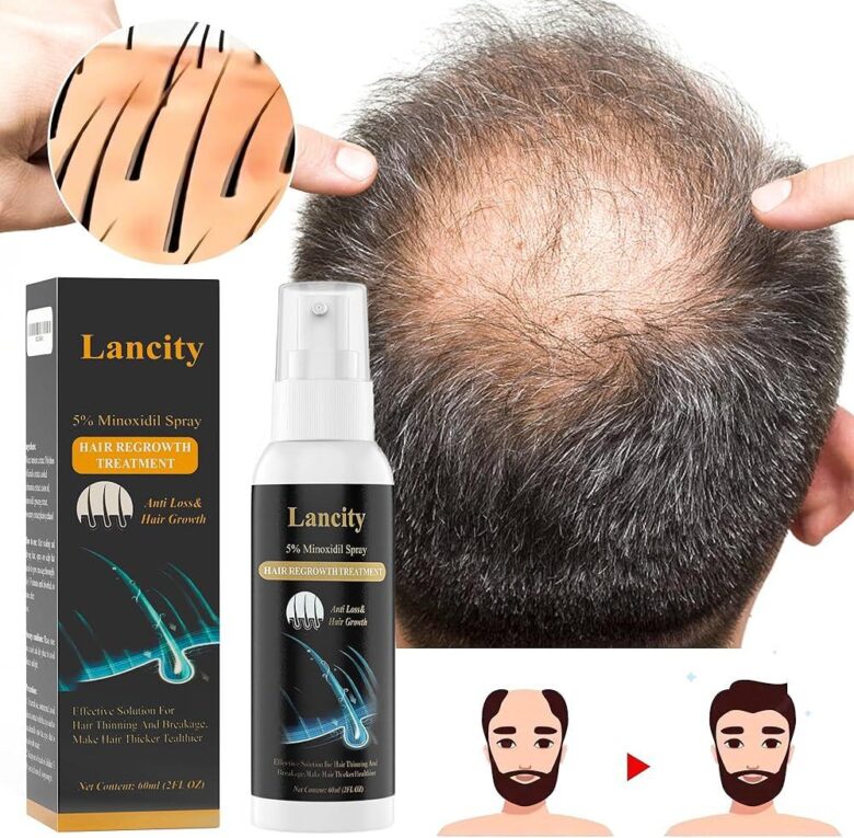 How to stimulate hair regrowth for men over 40