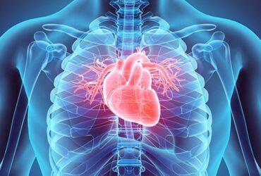 Testosterone therapy for cardiovascular health