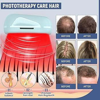 laser hair growth therapy