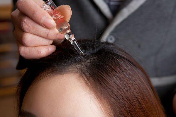 scalp treatments