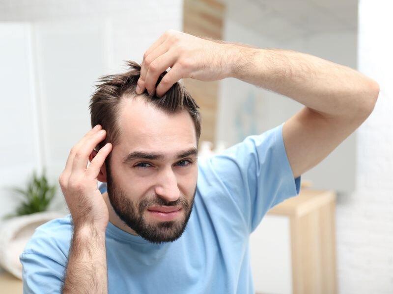 men's hair growth